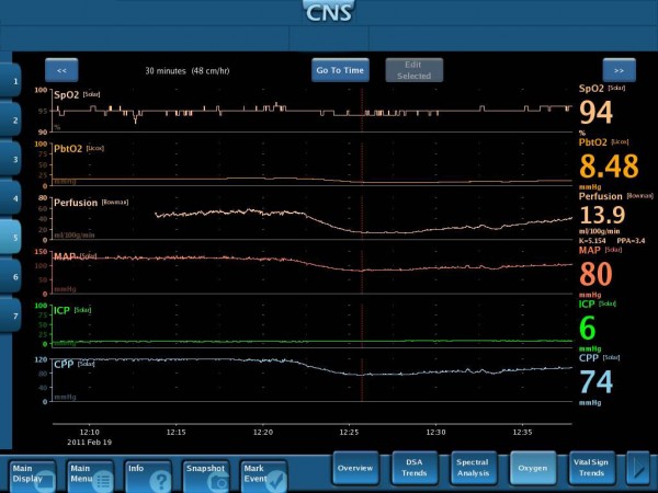 Multimodal monitoring concept showing integrated cerebral parameters