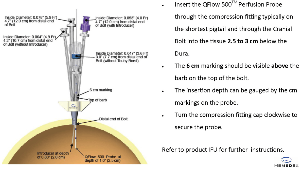 Quad Lumen Bolt placement guide diagram