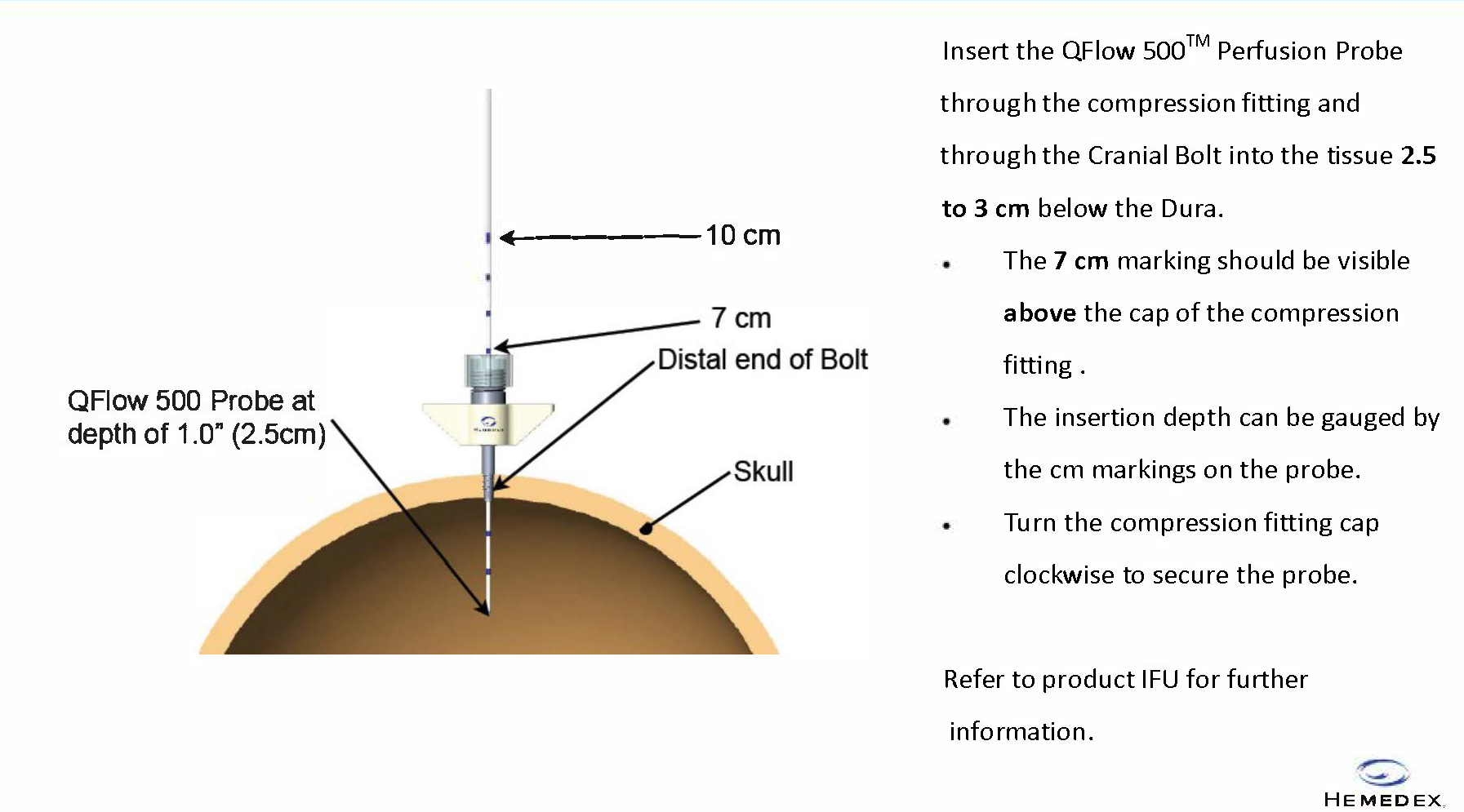 Single Lumen Bolt placement in cranium