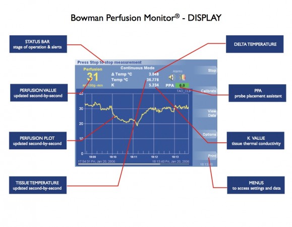 Bowman Perfusion Monitor — front display
